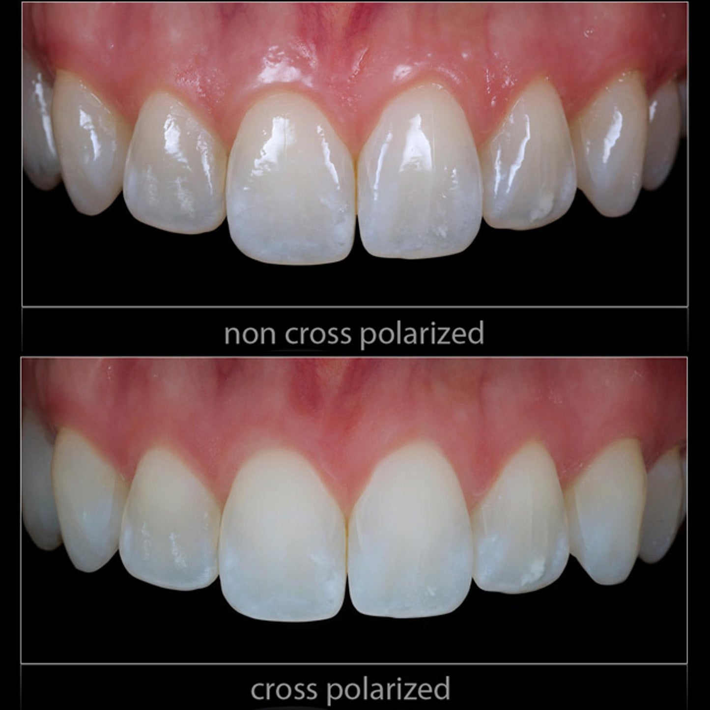 Cross Polarization Set For YONGNUO YN-14